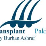 hair transplant clinic in lahore